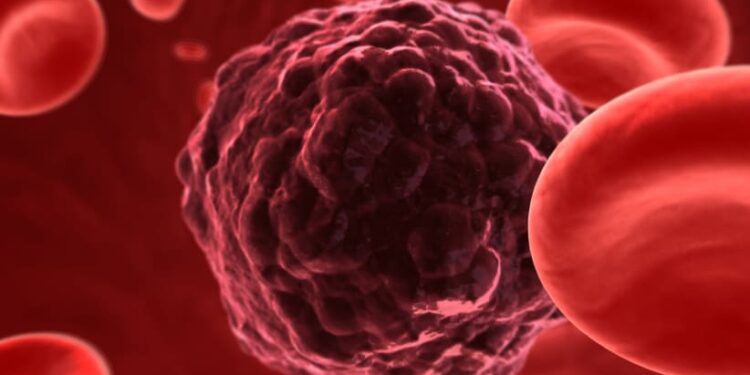 Immunai, AstraZeneca collaborate to optimize cancer clinical trials